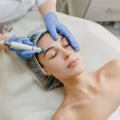 Gentle Exfoliation with Hydrodermabrasion: A Complete Guide to the Benefits and Process