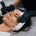 The Benefits, Process, and Cost of Hydrafacials: A Comprehensive Guide