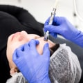 Painless Extraction of Impurities and Blackheads: A Comprehensive Guide
