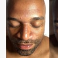 Understanding the Benefits of Hydrafacial Treatments