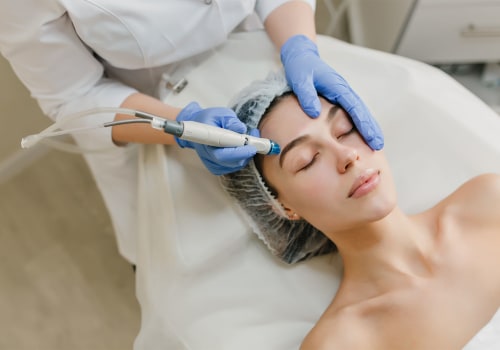 Gentle Exfoliation with Hydrodermabrasion: A Complete Guide to the Benefits and Process