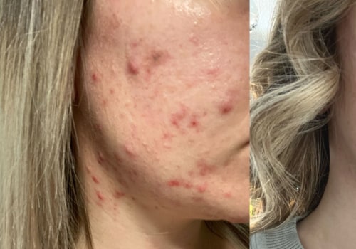 Before-and-after photos of various skin concerns