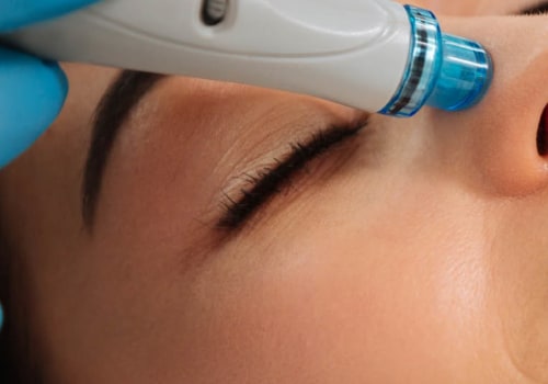 Exploring the Benefits and Results of Multiple Hydrafacial Treatments