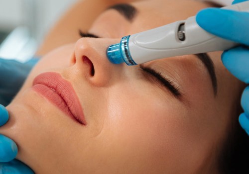 Deep Cleansing with Vortex Suction: The Ultimate Guide to Hydrafacials